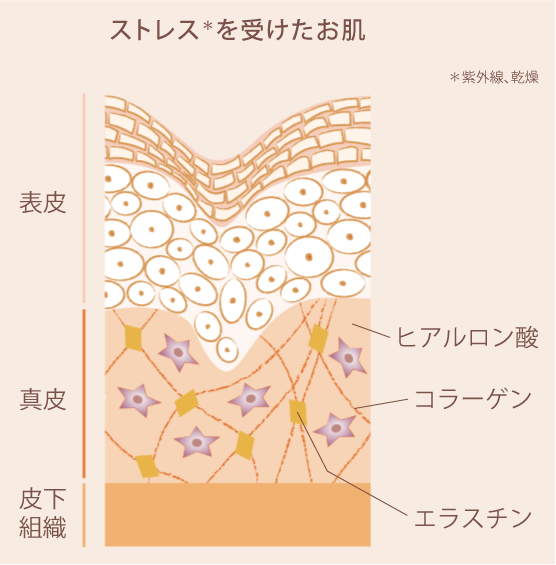 紫外線・乾燥によるストレスを受けたお肌のイラストイメージ